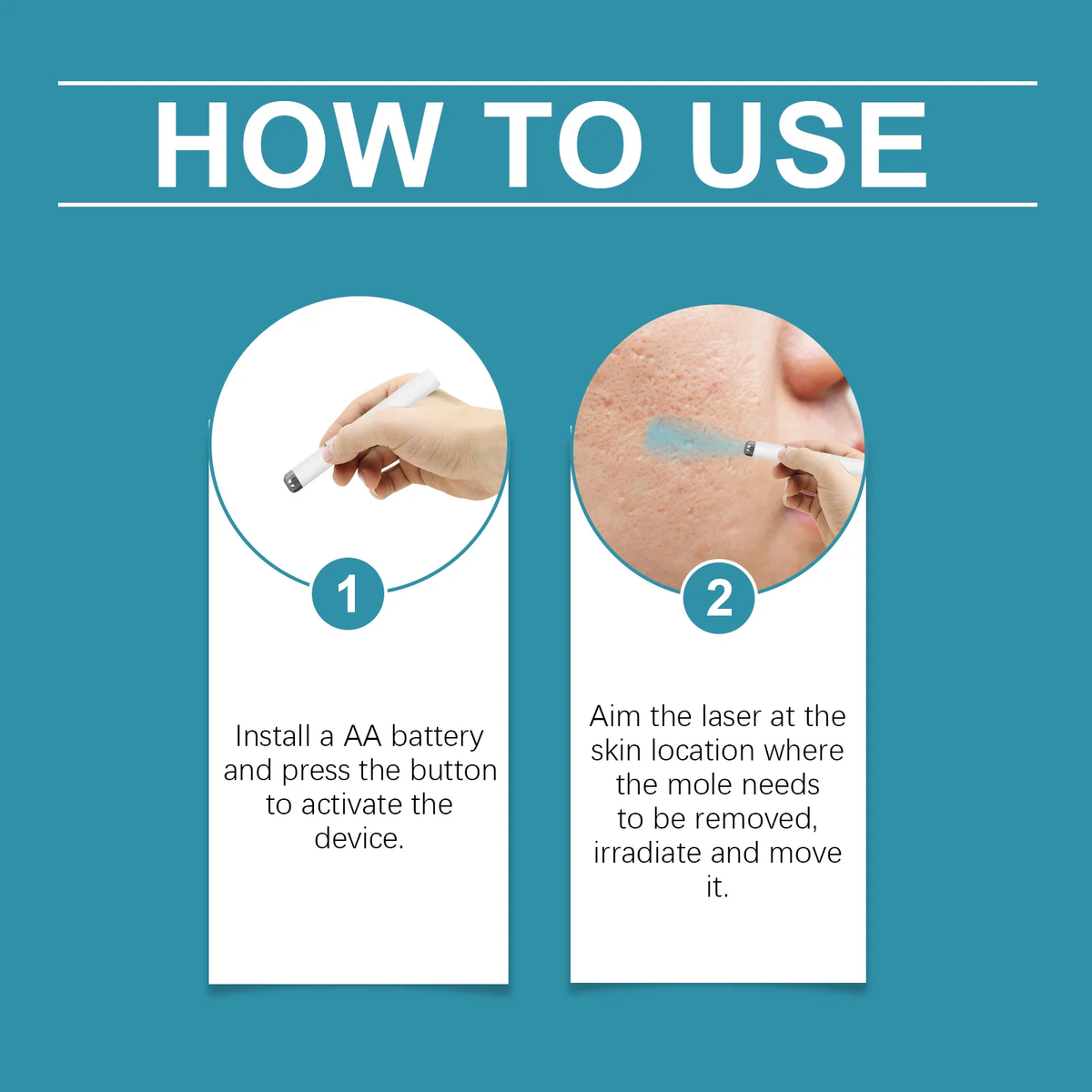 Xorita Laser Mole & Wart Removal Pen
